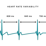 graph of heart rate variability and different times between pulses