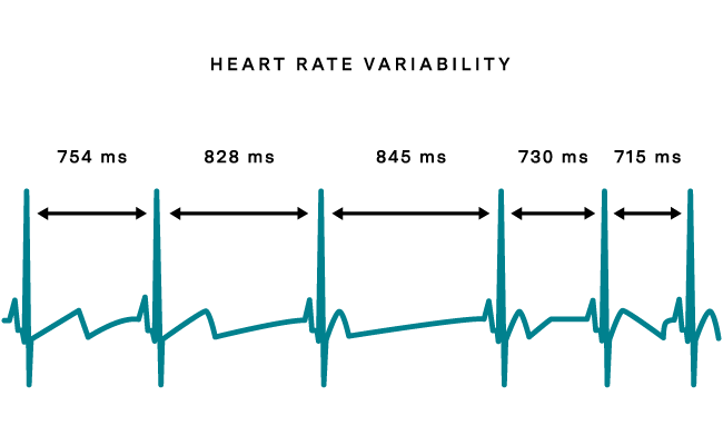 graph of heart rate variability and different times between pulses