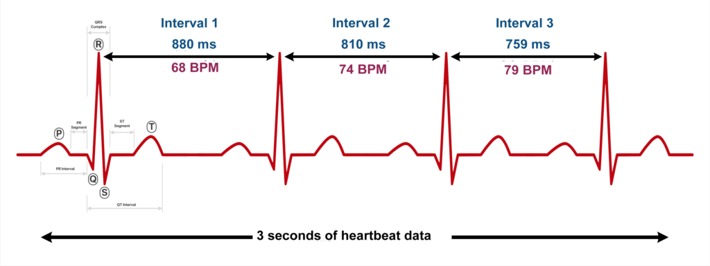 Graph of ECG of Heart Rate Variability aka HRV 2